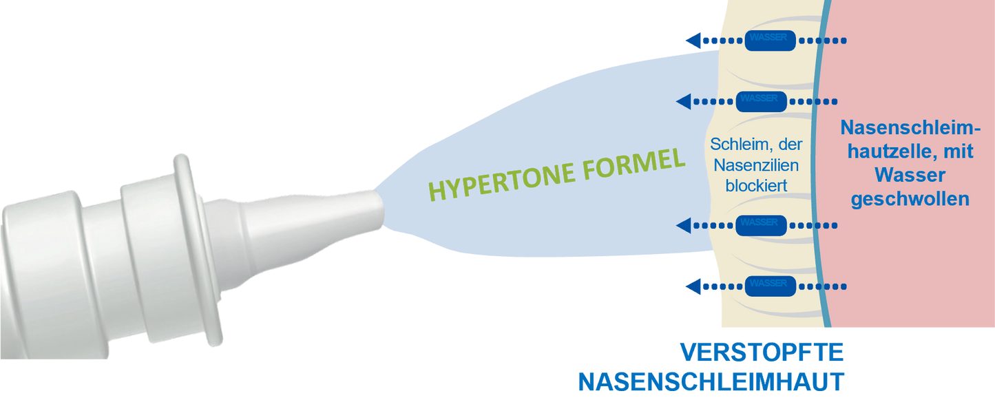 Sterimar Nasenspray verstopfte Nase