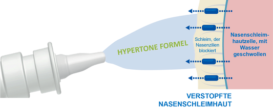 Sterimar Nasenspray Allergie